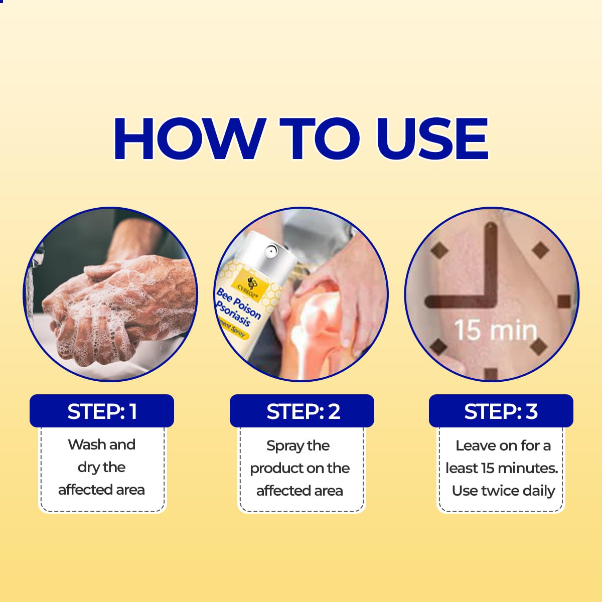 ⭐ CVREOZ® Bee Poison Psoriasis Treatment Spray 🐝 LIMITED OFFER 60% OFF 💛