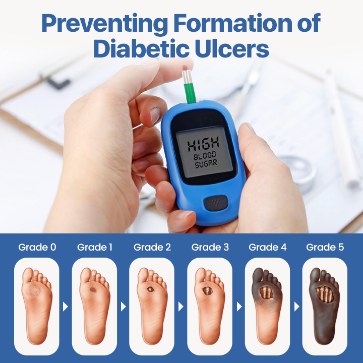 Last Day Promotion: 60% OFF⏰CVREOZ® VitaGluco Diabetes Treatment Cream