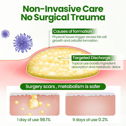 Cvreoz® KnotAway Lipoma Removal Cream