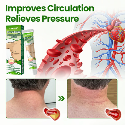 Cvreoz® KnotAway Lipoma Removal Cream