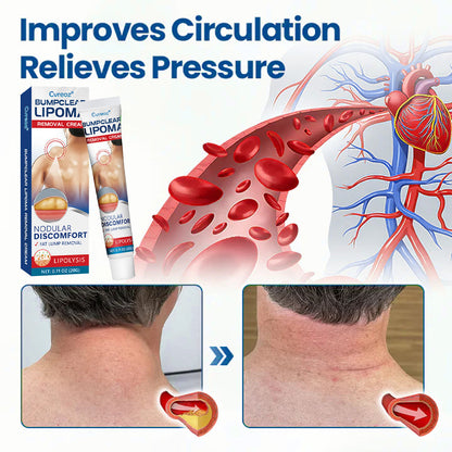 ⏰Last Day Promotion: 60% OFF🔥Cvreoz® Lipoma Removal Cream