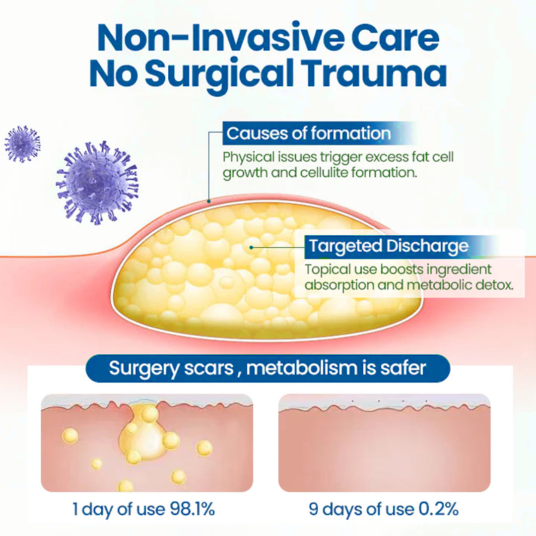 ⏰Last Day Promotion: 60% OFF🔥Cvreoz® Lipoma Removal Cream