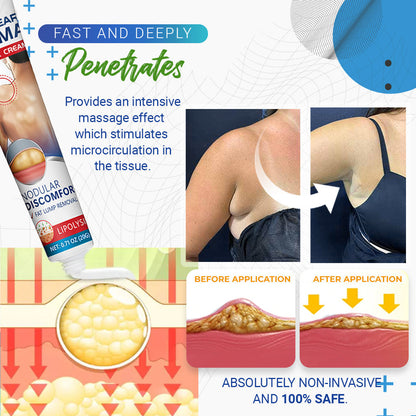 ⏰Last Day Promotion: 60% OFF🔥Cvreoz® Lipoma Removal Cream
