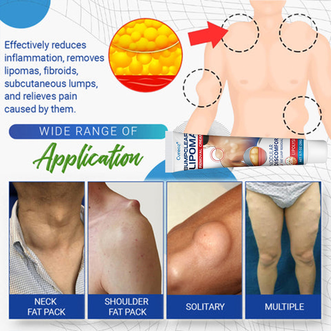 ⏰Last Day Promotion: 60% OFF🔥Cvreoz® Lipoma Removal Cream
