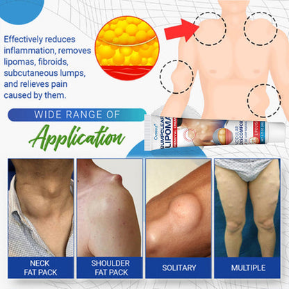 ⏰Last Day Promotion: 60% OFF🔥Cvreoz® Lipoma Removal Cream