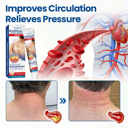 🎉SPECIAL OFFER: 60% OFF This Today Only!🔥Cvreoz® Lipoma Removal Cream