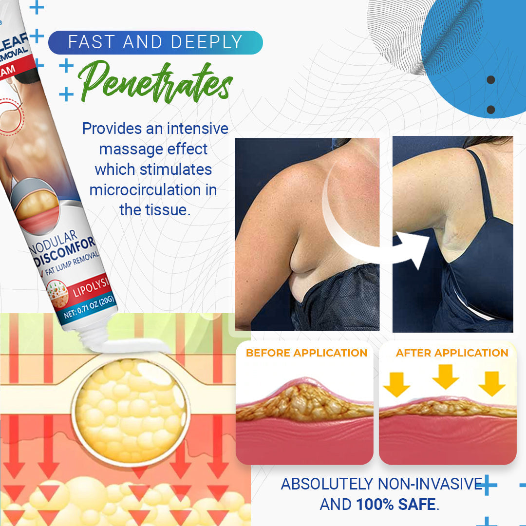 🎉SPECIAL OFFER: 60% OFF This Today Only!🔥Cvreoz® Lipoma Removal Cream