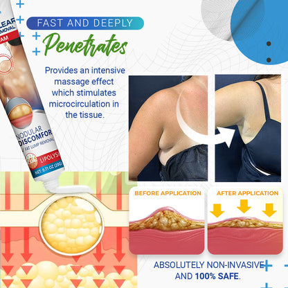 🎉SPECIAL OFFER: 60% OFF This Today Only!🔥Cvreoz® Lipoma Removal Cream