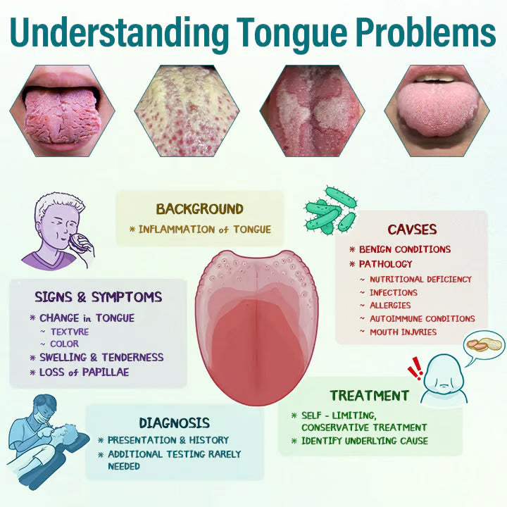 ⏰Last-Day Promotion: 60% OFF🔥CVREOZ® GlosShield Tongue Repair Spray👅