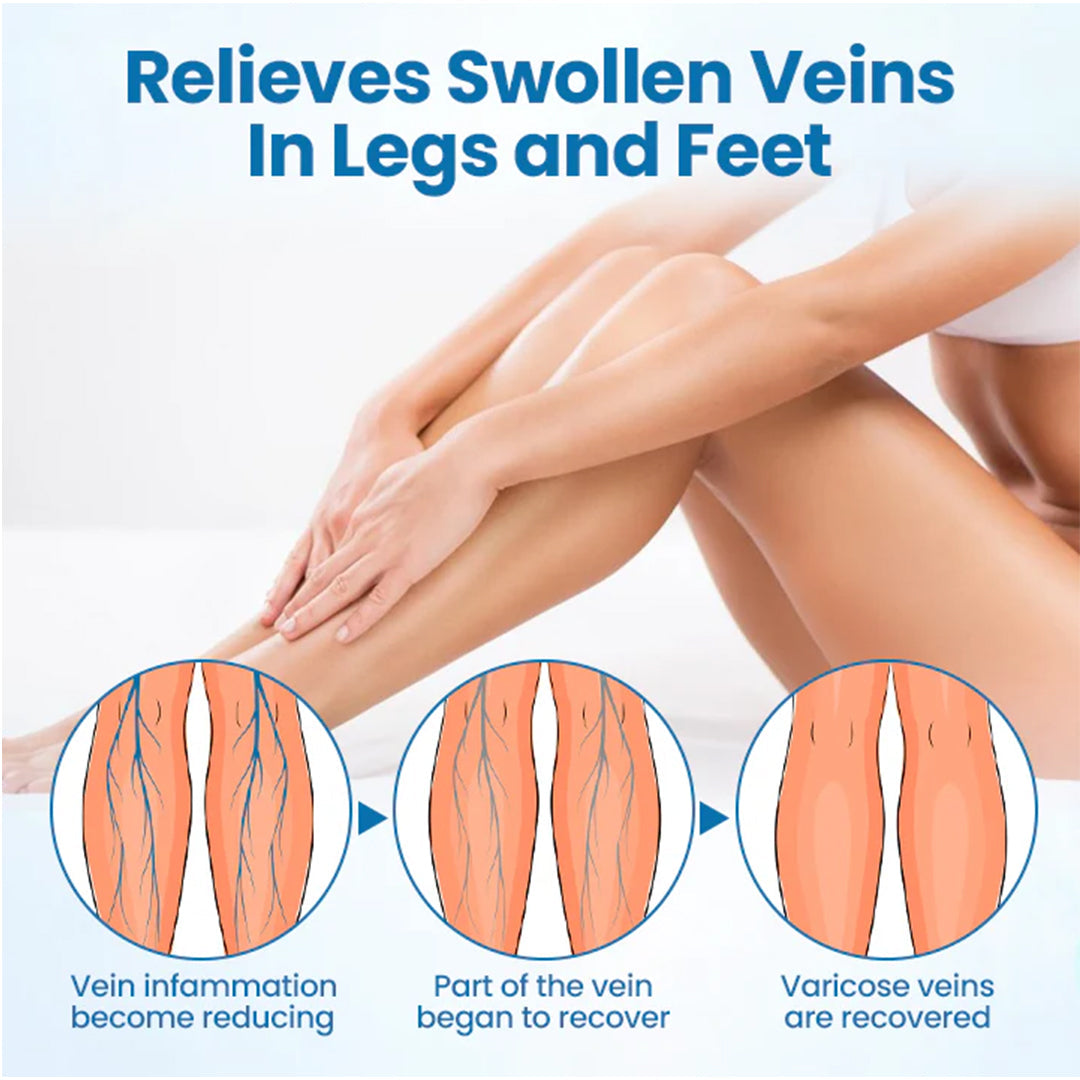 ⏰Last Day Promotion: 60% OFF🔥 Cvreoz® VeinGuard Herbal Spray