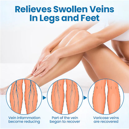 ⏰Last Day Promotion: 60% OFF🔥 Cvreoz® VeinGuard Herbal Spray