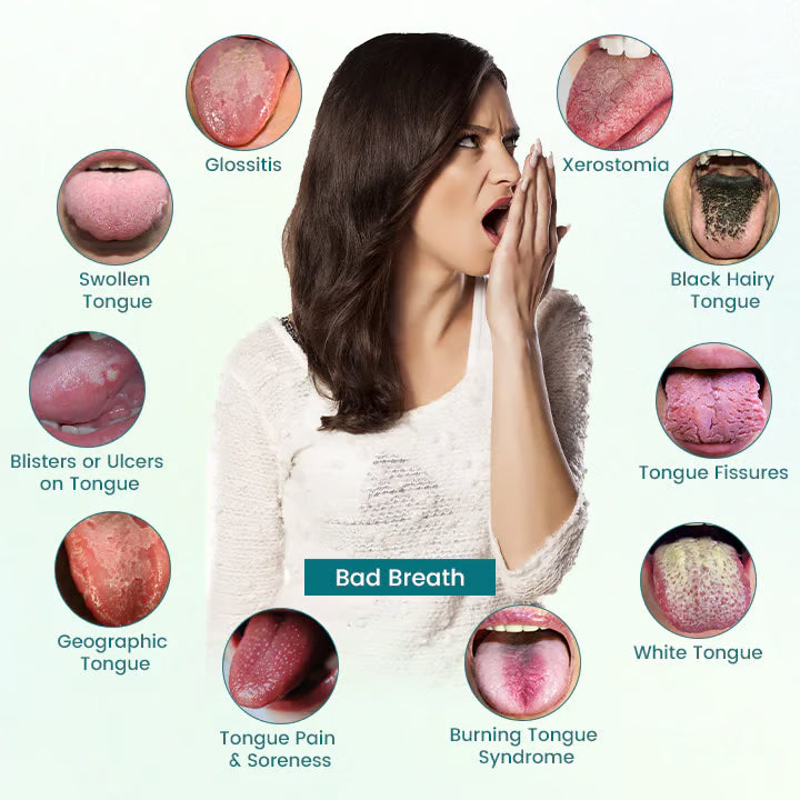 ⏰Last-Day Promotion: 60% OFF🔥CVREOZ® GlosShield Tongue Repair Spray👅