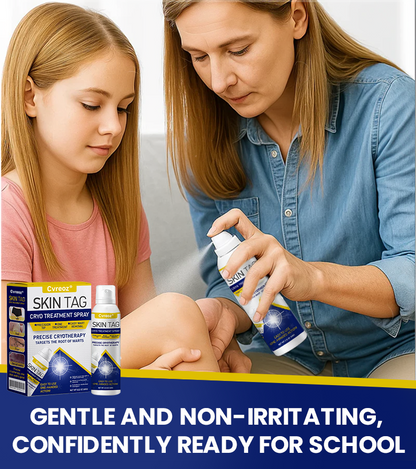 ⏰Last Day Promotion: 60% OFF🔥 Cvreoz® Skin Tag Cryo Treatment Spray