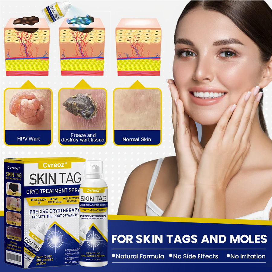 ⏰Last Day Promotion: 60% OFF🔥 Cvreoz® Skin Tag Cryo Treatment Spray
