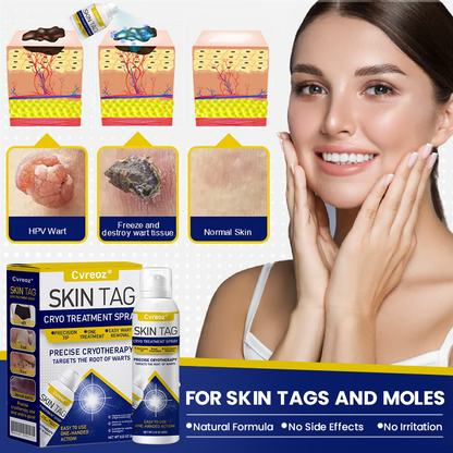 ⏰Last Day Promotion: 60% OFF🔥 Cvreoz® Skin Tag Cryo Treatment Spray