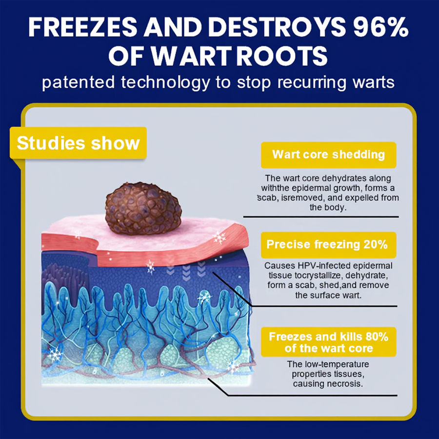 ⏰Last Day Promotion: 60% OFF🔥 Cvreoz® Skin Tag Cryo Treatment Spray