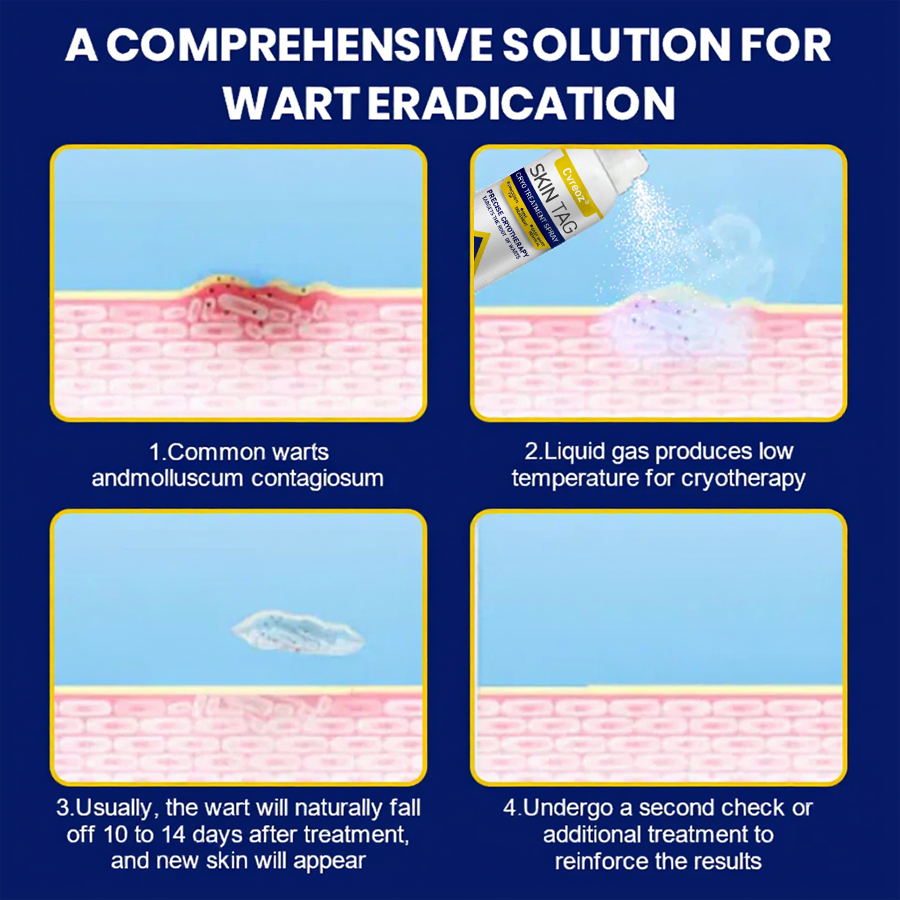 ⏰Last Day Promotion: 60% OFF🔥 Cvreoz® Skin Tag Cryo Treatment Spray