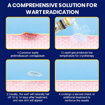 ⏰Last Day Promotion: 60% OFF🔥 Cvreoz® Skin Tag Cryo Treatment Spray