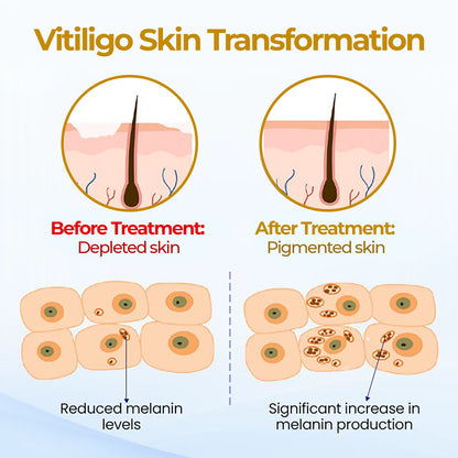 ⏰Last Day Promotion: 60% OFF🔥CVREOZ® Evenora Herbal Spray PRO