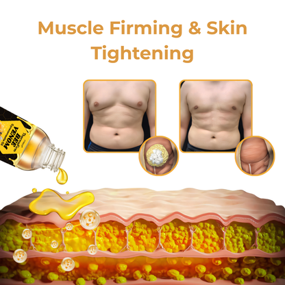 🎉SPECIAL OFFER: 60% OFF This Week Only!🔥Cvreoz® ThermoFirm Bee Venom Gynecomastia Oil