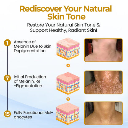 ⏰Last Day Promotion: 60% OFF🔥CVREOZ® Evenora Herbal Spray PRO