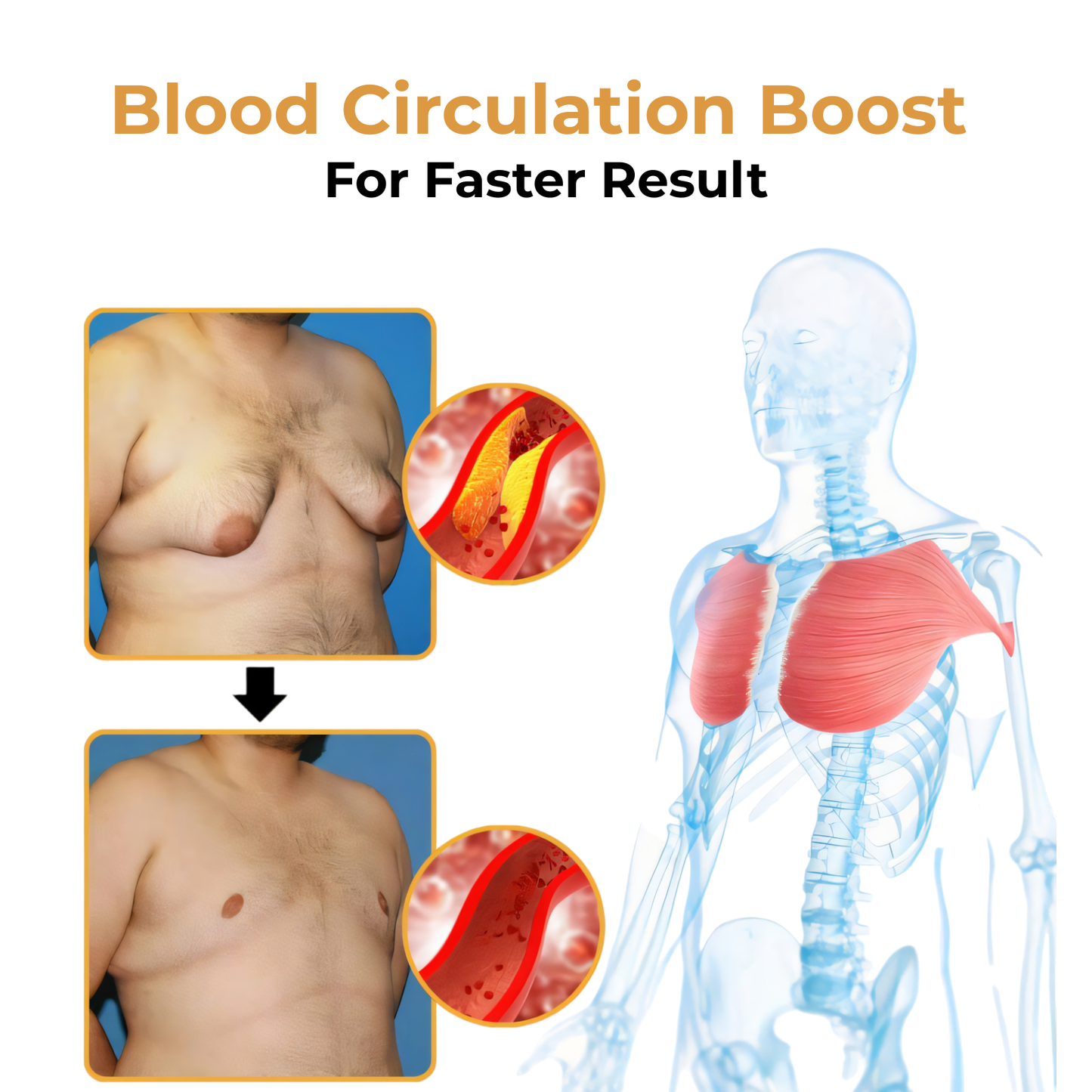 🎉SPECIAL OFFER: 60% OFF This Week Only!🔥Cvreoz® ThermoFirm Bee Venom Gynecomastia Oil