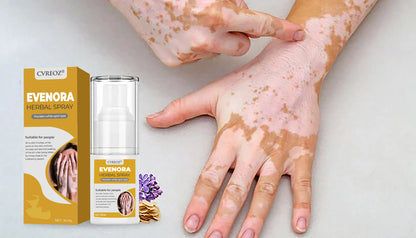 ⏰Last Day Promotion: 60% OFF🔥CVREOZ® Evenora Herbal Spray PRO