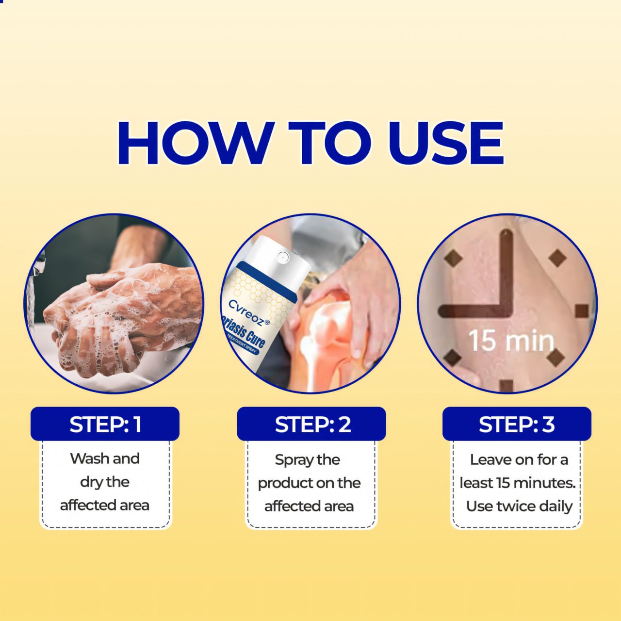 Cvreoz® Psoriasis Cure Bee Venom Treatment Spray 🔥NEWEST VERSION: SALE 60% OFF🐝