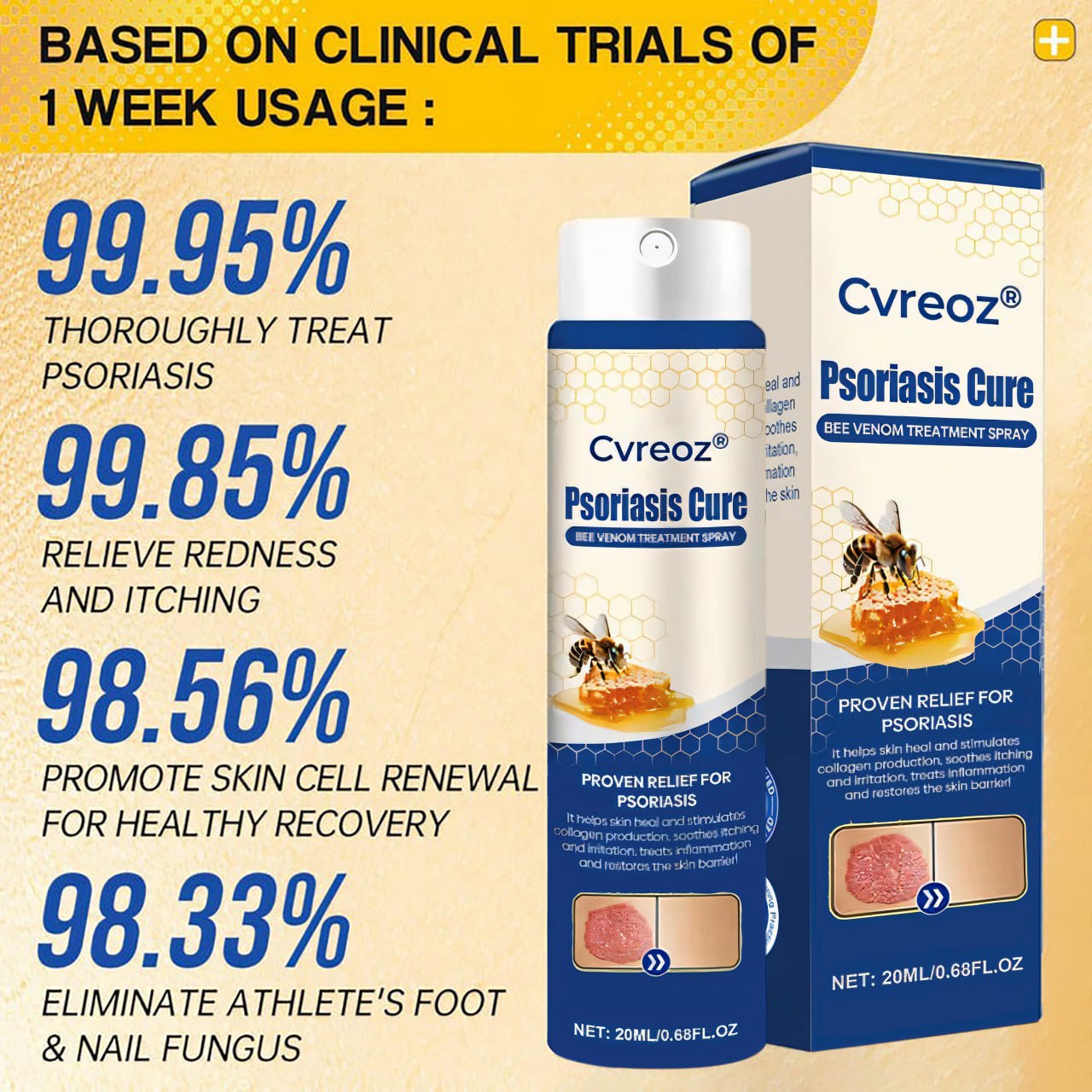 Cvreoz® Psoriasis Cure Bee Venom Treatment Spray 🔥NEWEST VERSION: SALE 60% OFF🐝