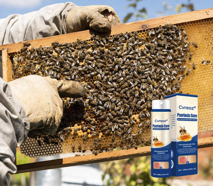 Cvreoz® Psoriasis Cure Bee Venom Treatment Spray 🔥NEWEST VERSION: SALE 60% OFF🐝